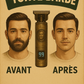 Tondeuse BostBeard™